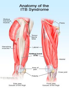 Anatomy of ITB Syndrome